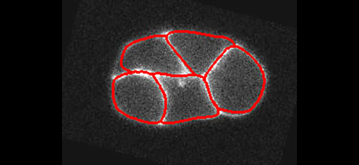 Segmentation of a C. elegans embryo