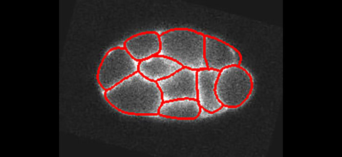 Segmentation of a C. elegans embryo