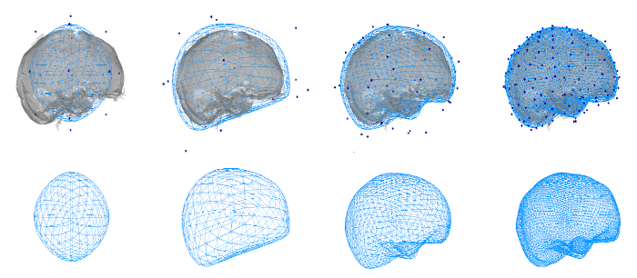 Brain segmentation