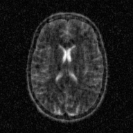 linear brain MRI reconstruction