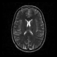 wavelet brain MRI reconstruction