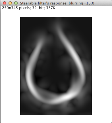 Steerable filter's response.